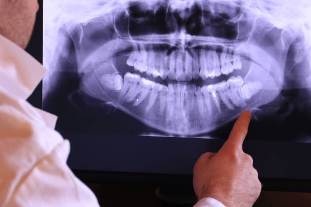 Best Cracked Tooth Emergency Dentist  in Nes, IL